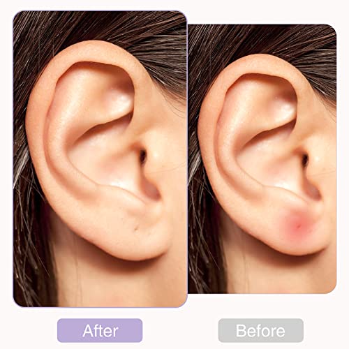 360 יחידות אוזן חור חוט עגילי הסרת ריח אוזן טיפול ערכת חד פעמי פירסינג טפול עוקב כלי מנקה פירסינג ניקוי קו עבור