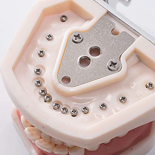 מודל שיניים נשלף של 28 יחידות לימוד תרגול מודל פרוטוקלי רך ג'ינג'ה