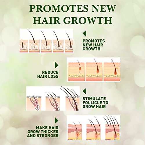 הרביש עיבוי שמפו ומרכך / שיער צמיחה ויטליזר / שיער צמיחת מהות שמן / מונע מוקדמת שיער אובדן-תומך בריא שיער צמיחה