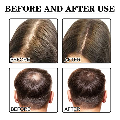 2 יחידות אלוריום שיער צמיחת סרום לנשים שחורות, אלוריום יופי שיער צמיחת סרום אנטי שיער אובדן להזין יבש פגום שיער