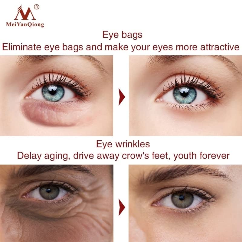 עיסוי עין נגד סרום עין מעסה קרם עיניים הסר עיגולים כהים שקית עיניים אנטי-סיבוביות לחות איפור טיפוח עור